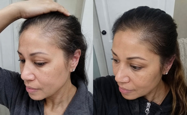 3 Months In — New growth along the parting